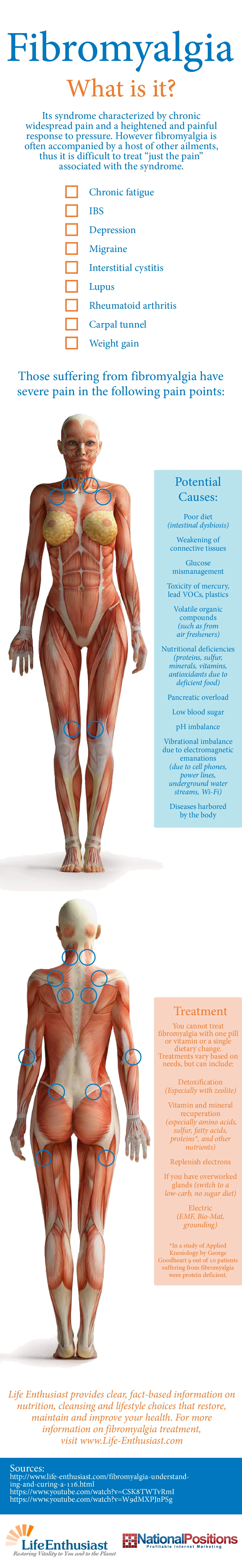 Fibromyalgia Is A Chronic Pain Disorder Causing Widespread Pain Fatigue And Sleep Disturbances Affecting Millions Worldwide. Understand Its Symptoms And Treatments.