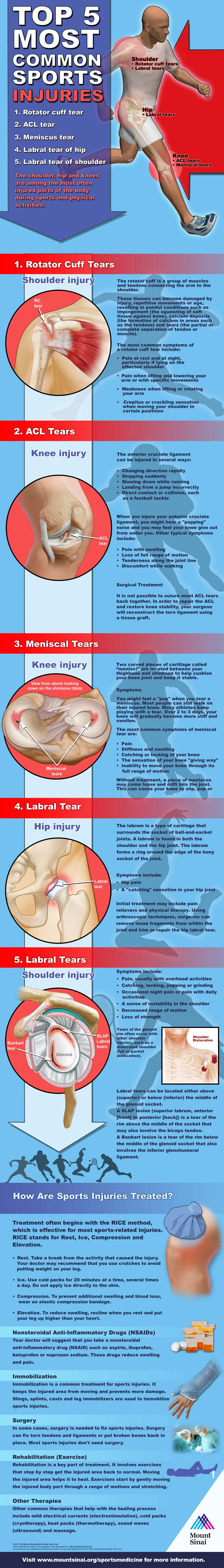 Top 5 Most Common Sports Injuries Include Sprains, Strains, Fractures, Tendonitis, And Concussions Affecting Athletes Of All Levels.